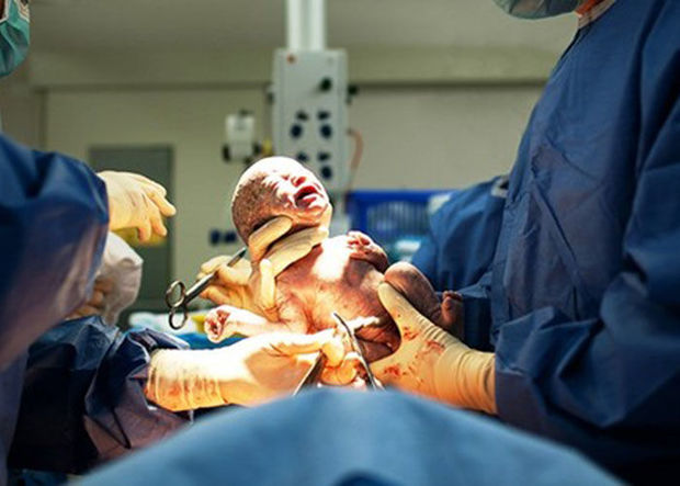 Həkim yeni doğulan körpəni şikəst etdi