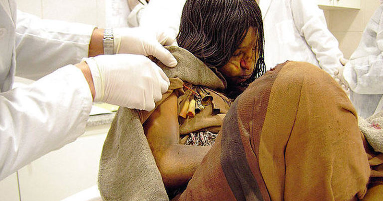 Mumiya tibb işçilərini mat qoydu - 