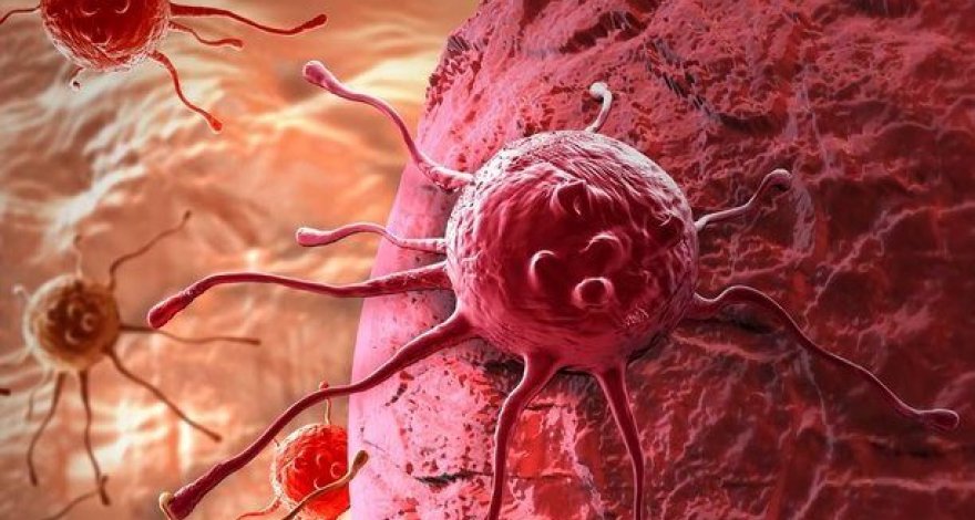 Онкологи назвали способ защититься от рака груди