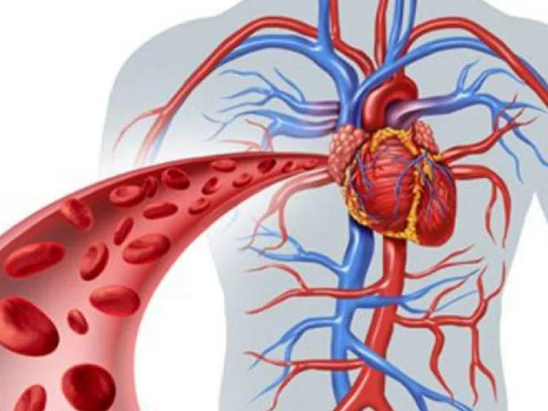 Damar tıxanmasına və insulta səbəb olan QİDALAR