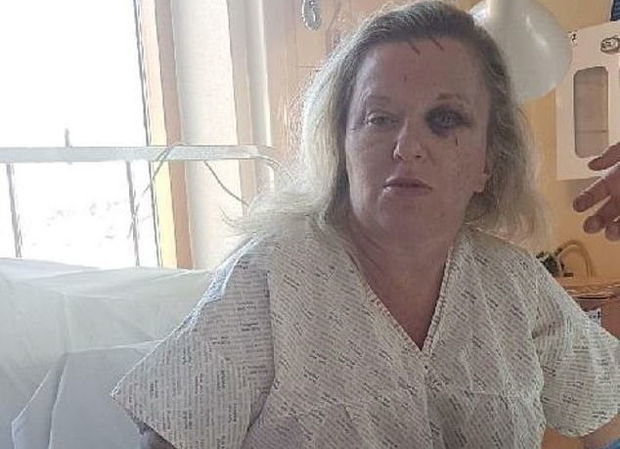 Всему виной - зависть: мать и дочь жестоко избили женщину - ФОТО