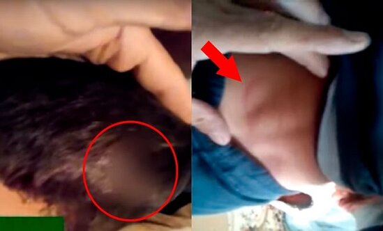 Azərbaycanda ana uşağını vəhşicəsinə döyüb qanını tökdü — ŞOK VİDEO