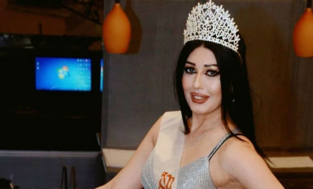 Azərbaycan gözəlindən YENİ PAYLAŞIM — Gözəlliyin göz qamaşdırır