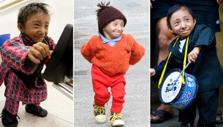 Dünyanın ən kiçik adamı vəfat edib — FOTO + VİDEO