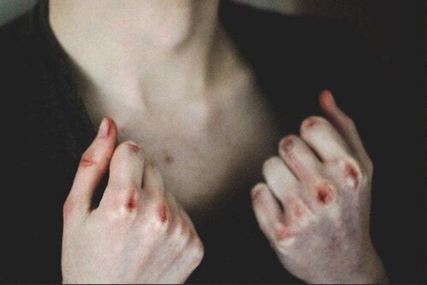 Bakıda qadın əri tərəfindən vəhşicəsinə döyüldü