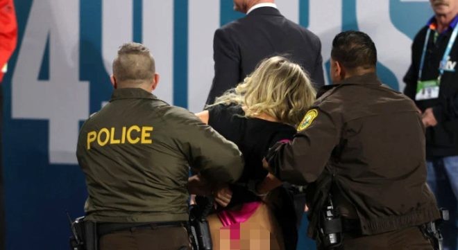 Model bir anda özünü meydana atdı - Paltarını yuxarı çəkib... (FOTOLAR)