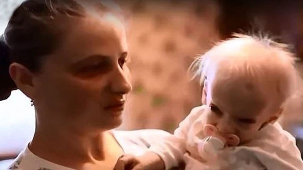 Səkkiz yaşlı uşaq qocalıqdan öldü - VİDEO