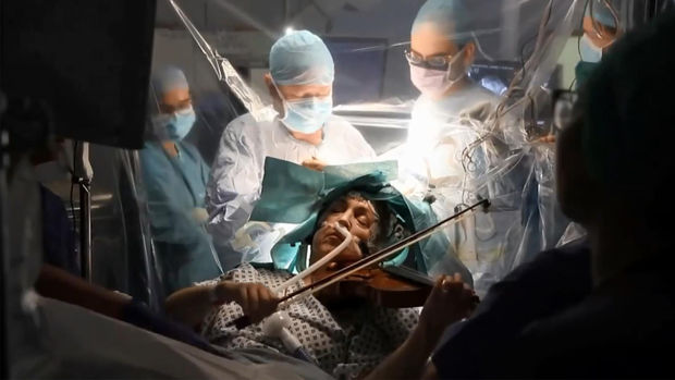 Xəstə beyin əməliyyatı zamanı skripka çaldı - VİDEO