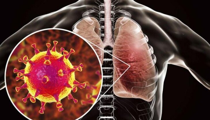 Koronavirus immuniteti zəif olanları məhv edir