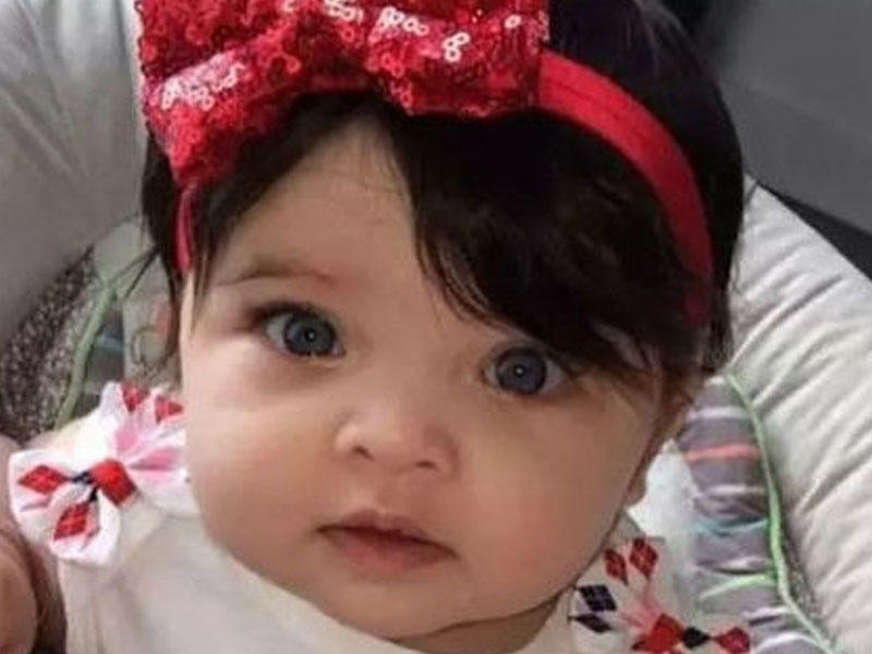 Dünya bu 11 aylıq qıza heyrandır - FOTO