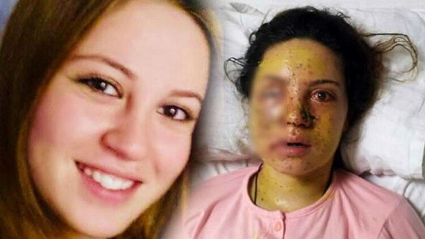 Boşanmaq istəyən 21 yaşlı həyat yoldaşını gözündən güllələdi - FOTO