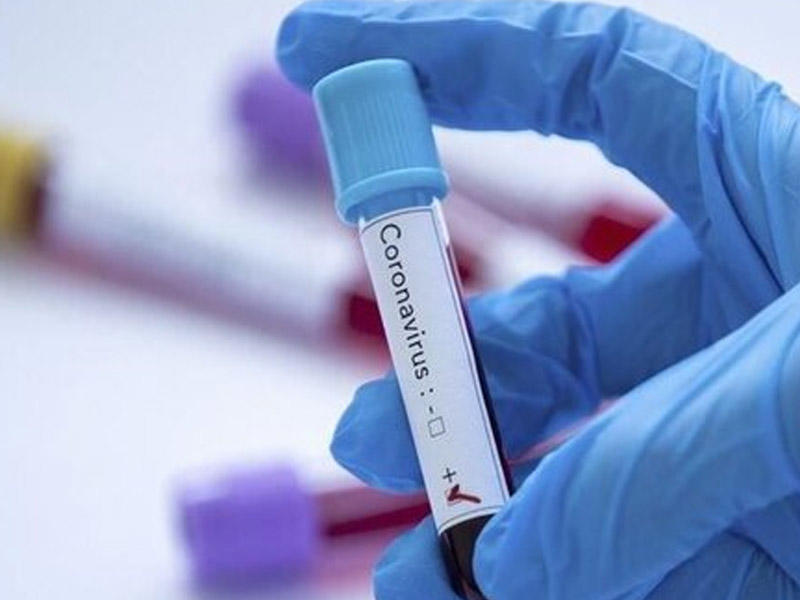“Koronavirus deyildiyi qədər qorxulu deyil” - İnfeksionistdən açıqlama