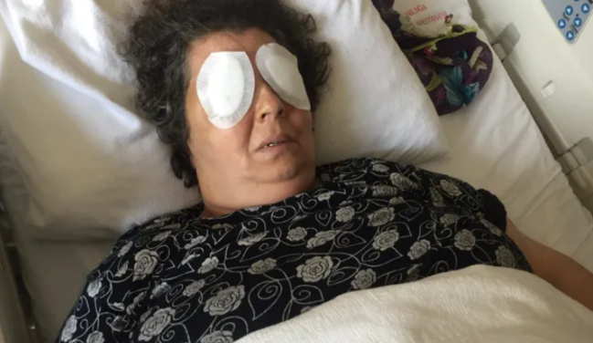 Xəstəxanada DƏHŞƏT: Qadının gözlərini əlləriylə çıxarıb yedi - FOTO