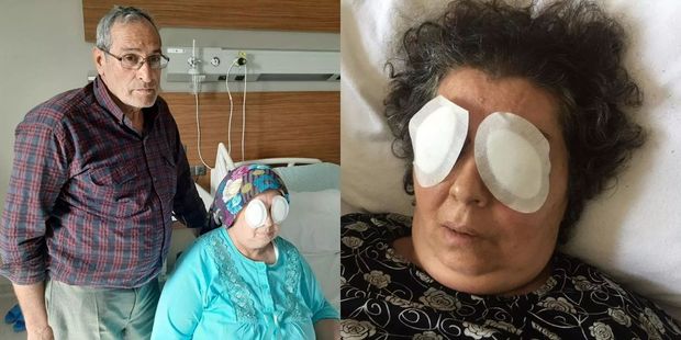 Qadının gözlərini çıxarıb yedi - VİDEO