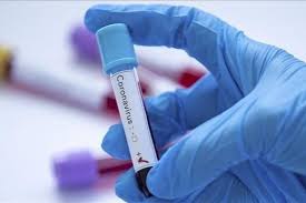 Bu qaydalara əməl etdikdə koronavirus qorxulu deyil - Əhaliyə tövsiyələr