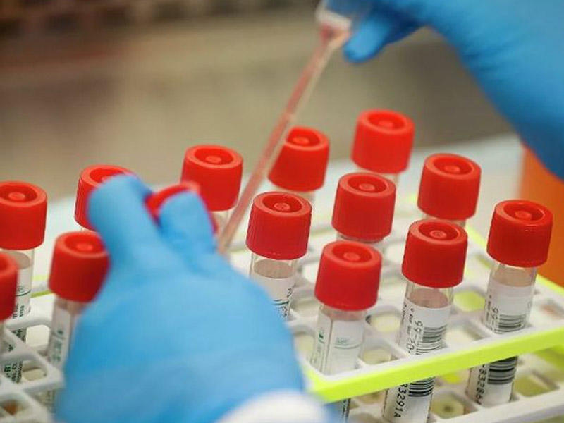 Sinqapurda 5 dəqiqəyə koronavirusu aşkar edən test hazırlanıb