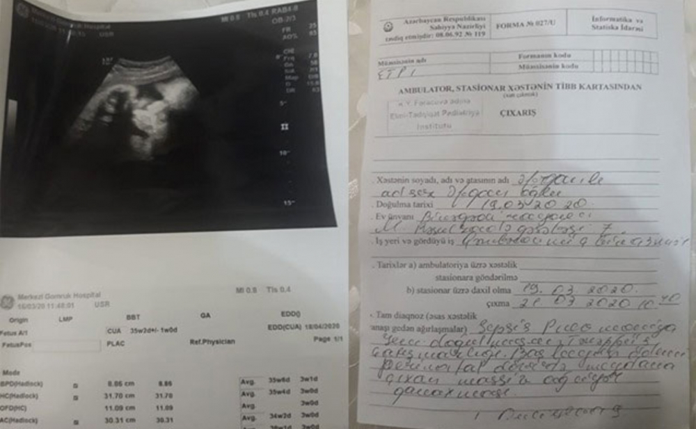 Bakıda qeysəriyyə əməliyyatından sonra körpə öldü - Foto