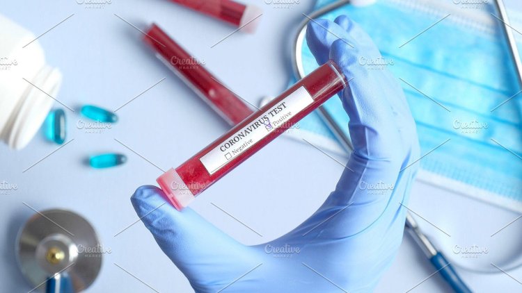 SON DƏQİQƏ: Azərbaycanda daha 43 nəfərdə koronavirus tapıldı - RƏSMİ