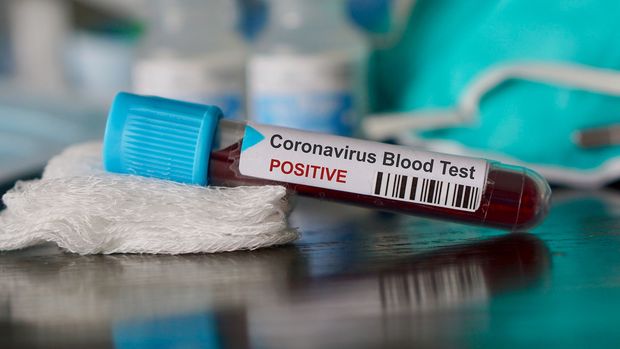 Azərbaycanda 43 yeni koronavirus (COVID-19) infeksiyasına yoluxma faktı qeydə alın - RƏSMİ
