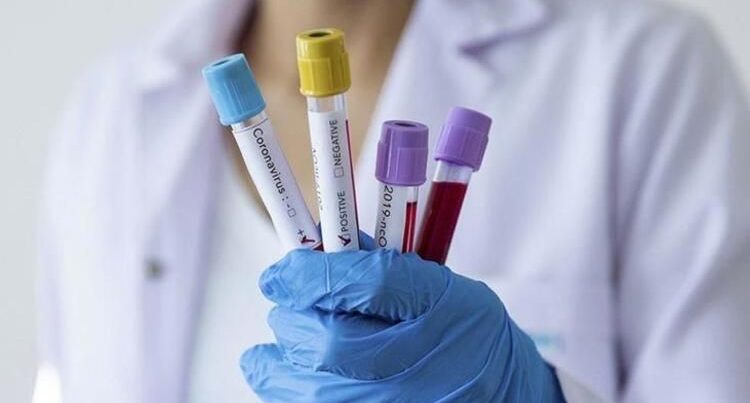 Bu xəstəlikdən əziyyət çəkənlərin virusa yoluxma riski 2-3 dəfə artacaq - XƏBƏRDARLIQ