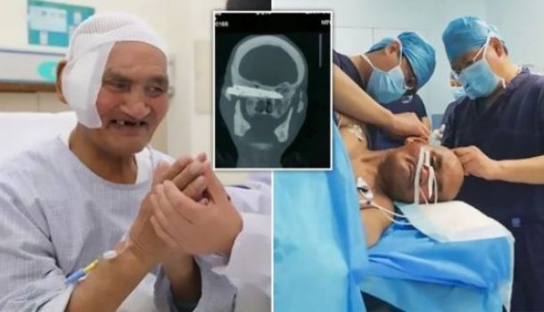 26 ildir başında ilişmiş bıçaq çıxarıldı - Şok əməliyyat