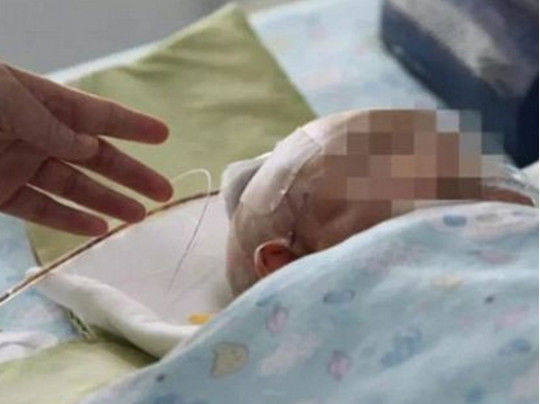 11 yaşlı qızın eyvandan atdığı alma üç aylıq körpəni komaya saldı