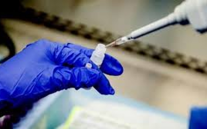 Koronavirus daha 4 orqanı sıradan çıxarır