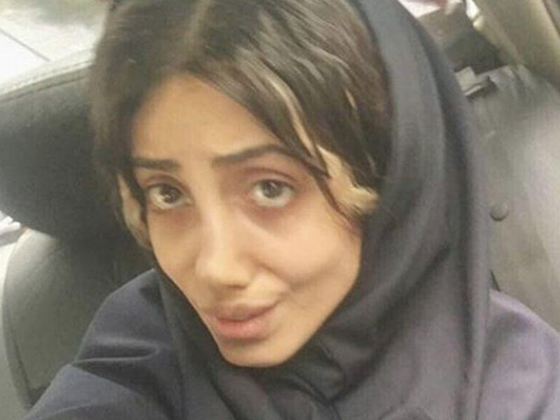 Özünü Ancelinaya oxşadan iranlı qız da koronavirusa yoluxdu - FOTO