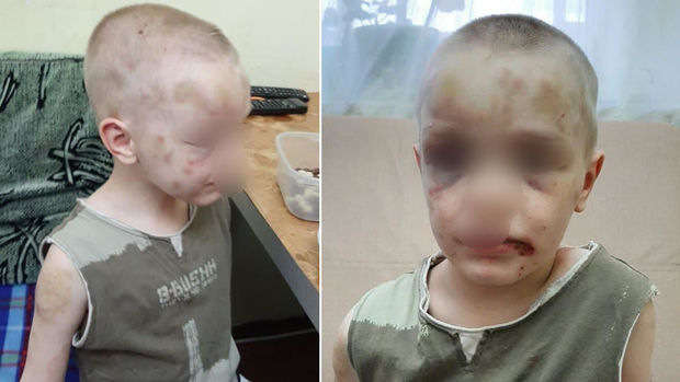 Rusiyada ana azyaşlı oğluna işgəncə verib