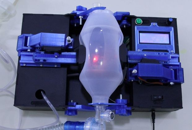 Azərbaycanlı mühəndislər süni tənəffüs aparatı hazırladılar - VİDEO