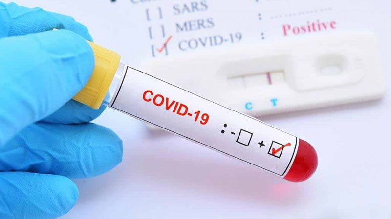 Son 24 saatda ölkədə neçə nəfər koronavirusa yoluxub? (RƏSMİ)