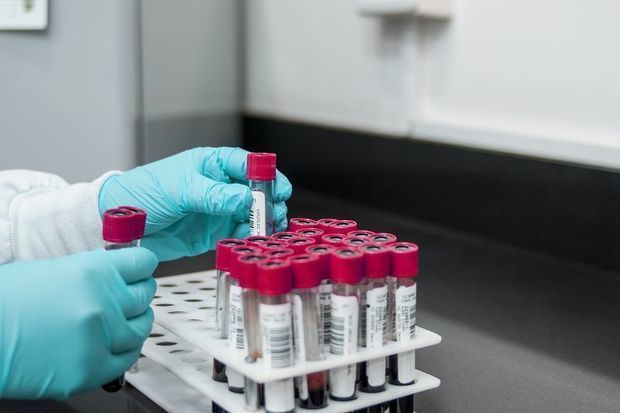 В Азербайджане от COVID-19 вылечились еще 65 человек - ОФИЦИАЛЬНО