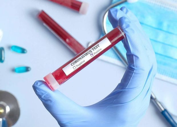 Число вылечившихся от COVID-19 в мире превысило 807 000