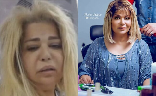 Plastik əməliyyat etdirdiyini gizlətmək istədi alınmadı - Video