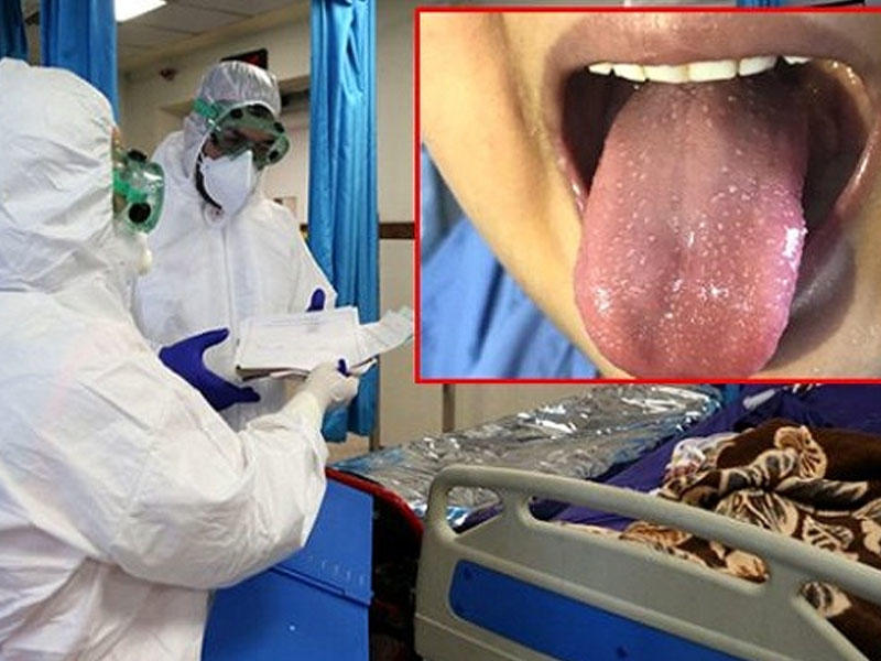 İngiltərədə daha bir dəhşətli xəstəlik ortaya ÇIXDI