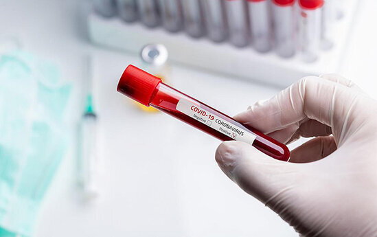 Azərbaycanda daha 49 nəfərdə koronavirus aşkarlandı - 46 nəfər sağaldı
