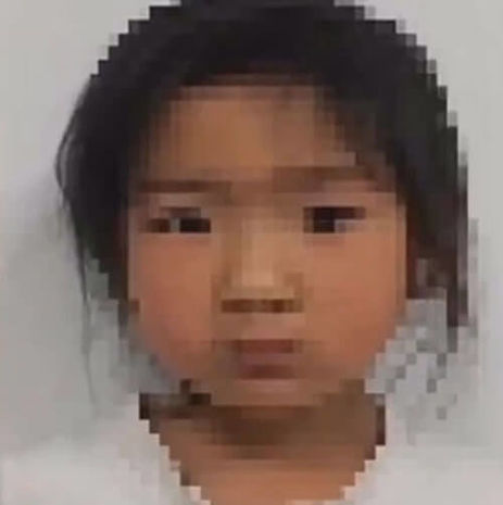 Çində oyuncağın fitini udan uşaq əlacsız qaldı – VİDEO