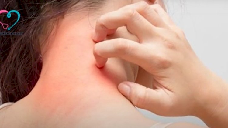 Koronaviruslu xəstələrin dərisində bu dəyişikliklər olur - Video