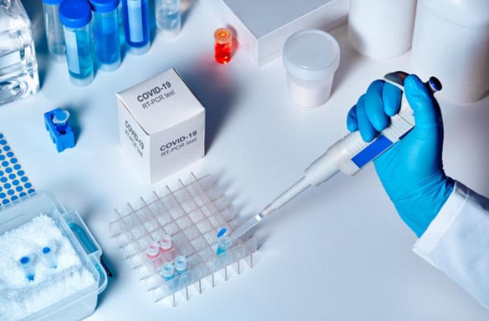 Bu gün 30 nəfər koronavirusdan sağalaraq evə buraxılıb - RƏSMİ