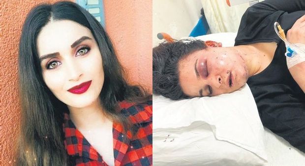 Arvadını stula bağlayıb, saatlarla işgəncə verdi - FOTO/VİDEO