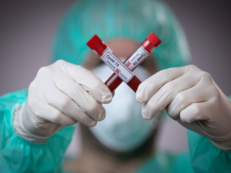 Daha 121 nəfərdə koronavirus aşkarlandı: 44-ü sağaldı