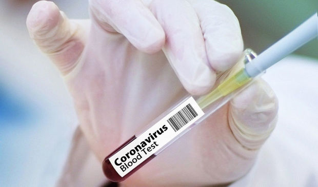 Sinqapurda antikoru bir saata təyin edən test hazırlandı