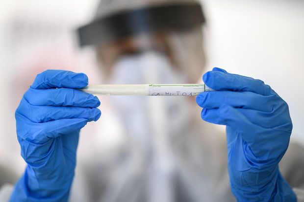 Azərbaycanda nazirliyin 15 əməkdaşında koronavirus aşkarlandı - RƏSMİ AÇIQLAMA