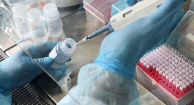 В Азербайджане выявлено 158 новых случаев инфицирования COVID-19