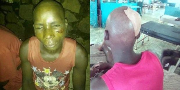 Tələbəni oğurlayıb, diri-diri dəfn etmək istədilər - FOTO