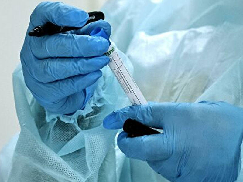 Azərbaycanda televiziya əməkdaşı koronavirusa yoluxdu - Digəri isə karantinə alındı