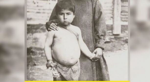 Bu uşağın hazırda hansı məşhur müğənnimiz olduğunu bilənlər TƏƏCÜBLƏNDİ - FOTO