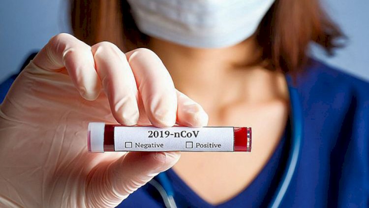 Virusa inanmayanlar üçün: Ölən 100 min nəfərin adı açıqlandı