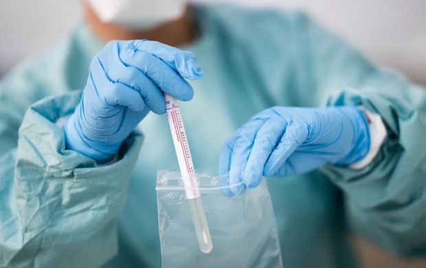 Azərbaycanda daha 149 nəfər koronavirusa yoluxdu, 134 nəfər sağaldı, 2 nəfər öldü