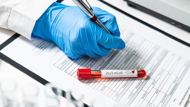 Azərbaycanda bir kənddə 21 nəfər virusa yoluxdu